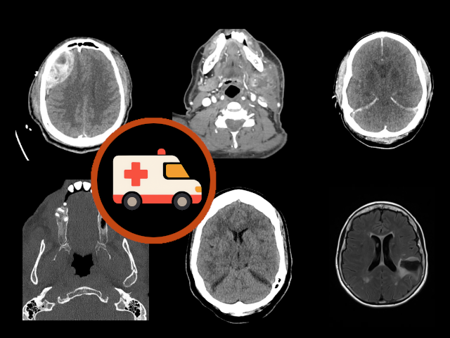 ED Neuroradiology